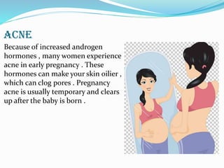 ACNE
Because of increased androgen
hormones , many women experience
acne in early pregnancy . These
hormones can make your skin oilier ,
which can clog pores . Pregnancy
acne is usually temporary and clears
up after the baby is born .
 