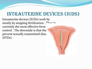 INTRAUTERINE DEVICES (IUDs)
Intrauterine devices (IUDs) work by
mostly by stopping fertilization . They’re
currently the most effective form of birth
control . The downside is that they don’t
prevent sexually transmitted diseases
(STDs) .
 