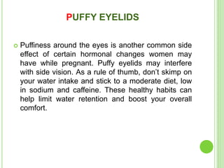 PUFFY EYELIDS
 Puffiness around the eyes is another common side
effect of certain hormonal changes women may
have while pregnant. Puffy eyelids may interfere
with side vision. As a rule of thumb, don’t skimp on
your water intake and stick to a moderate diet, low
in sodium and caffeine. These healthy habits can
help limit water retention and boost your overall
comfort.
 
