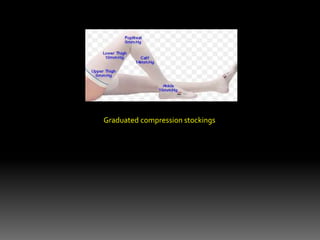 Graduated compression stockings
 