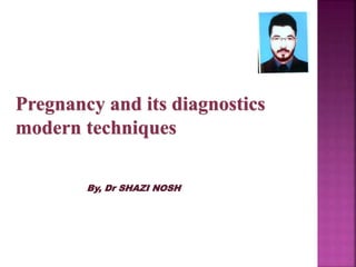 Pregnancy and its diagnostics
modern techniques
By, Dr SHAZI NOSH
 