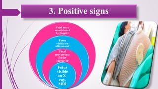 3. Positive signs
Fetal heart
sounds heard
by Doppler
Fetus
visible on
ultrasound
Fetal
movements
felt by
caregiver
Fetus
visible
on X-
ray,
MRI
 