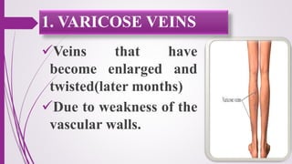 Veins that have
become enlarged and
twisted(later months)
Due to weakness of the
vascular walls.
1. VARICOSE VEINS
 