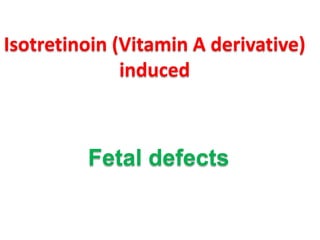Isotretinoin (Vitamin A derivative)
induced

Fetal defects

 