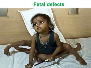 Fetal defects

 