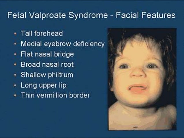 Valproic Acid Dose In Pregnancy