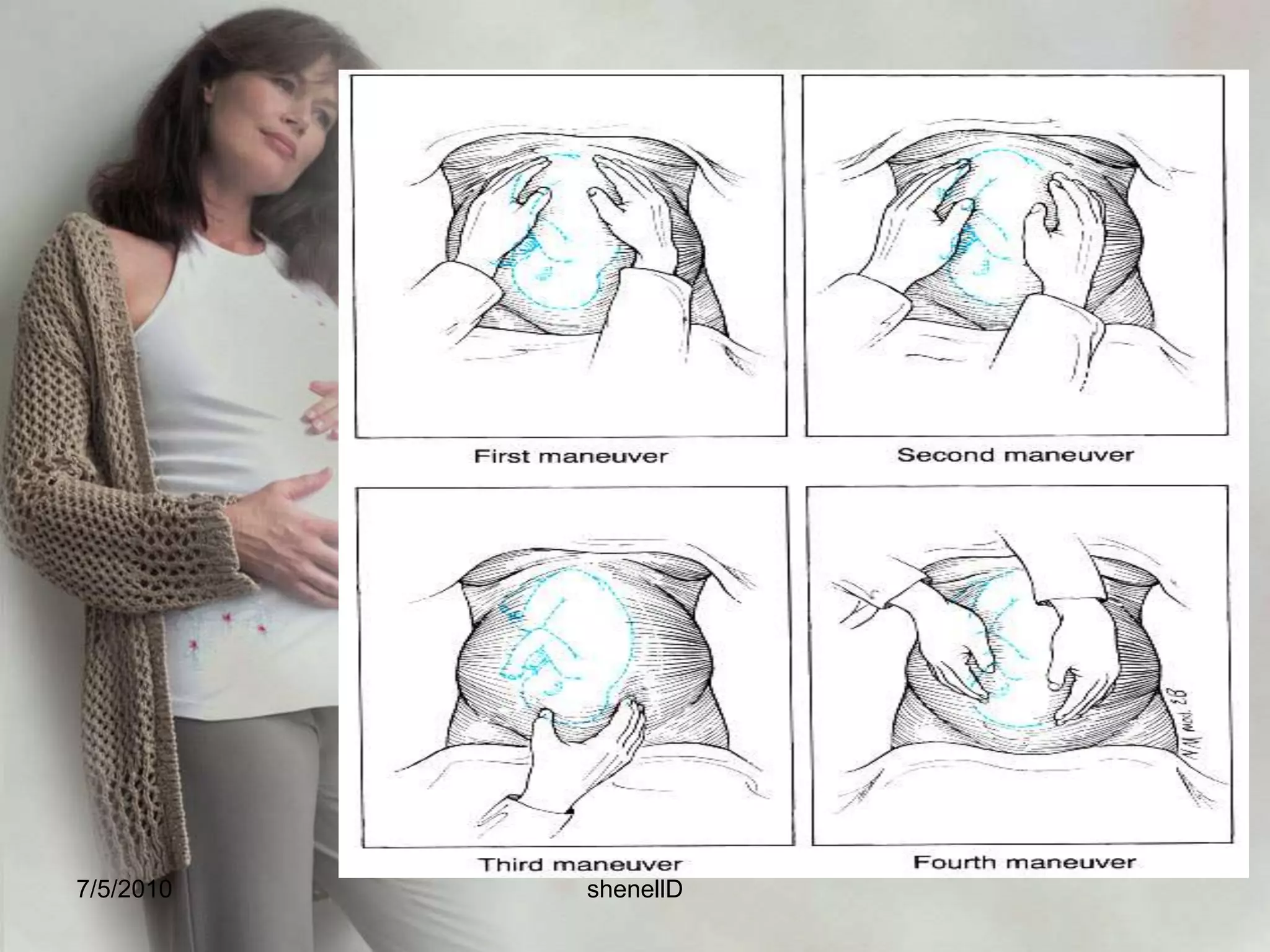 Physical AssessmentLEOPOLD’S MANUEVERa systematic method of observation and palpation to determine the presenting part, fetal position, presentation and engorgement. The woman should be in supine position with her knees flexed slightly.7/4/2010shenellD