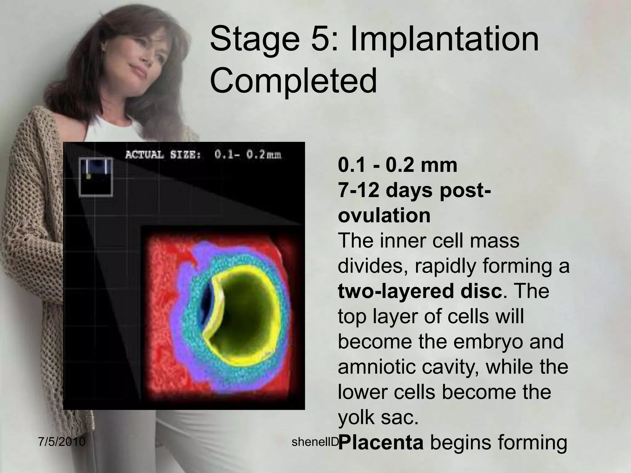 Stage 1: Fertilization1 day post-ovulation1 Egg, 300 Million Sperm0.1 - 0.15 mmFertilization begins when a sperm penetrates an an egg  and it ends with the creation of the zygote. Fertilization takes about 24 hours.7/4/2010shenellD