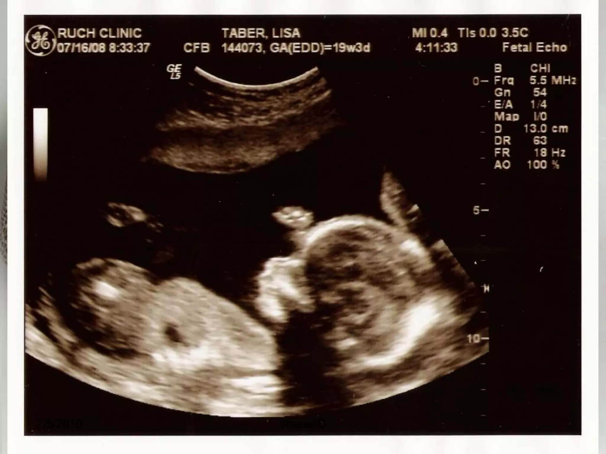 Stage 5: Implantation Completed0.1 - 0.2 mm7-12 days post-ovulationThe inner cell mass divides, rapidly forming a two-layered disc. The top layer of cells will become the embryo and amniotic cavity, while the lower cells become the yolk sac.Placenta begins forming7/4/2010shenellD