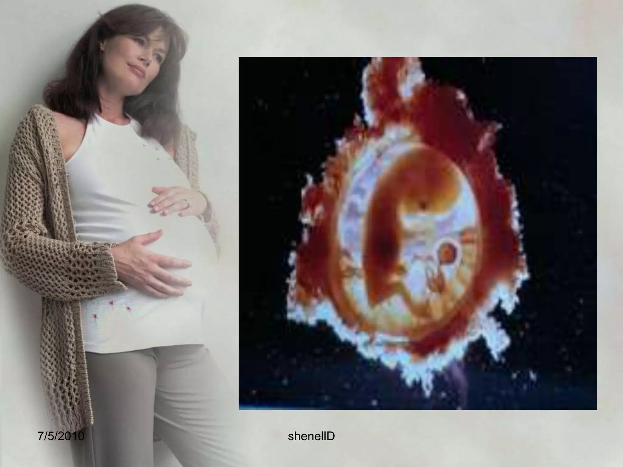 The placentaArises out of trophoblast tissue. It contains 20 cotyledons and weighs 400-600 grams. The rate of uteroplacental blood flow in pregnancy increases about 50 ml/min at 10 weeks to 500 to 600 ml/min at term. It develops by the third month and formed by union of chorionic villi and deciduas basalis. 7/4/2010shenellD