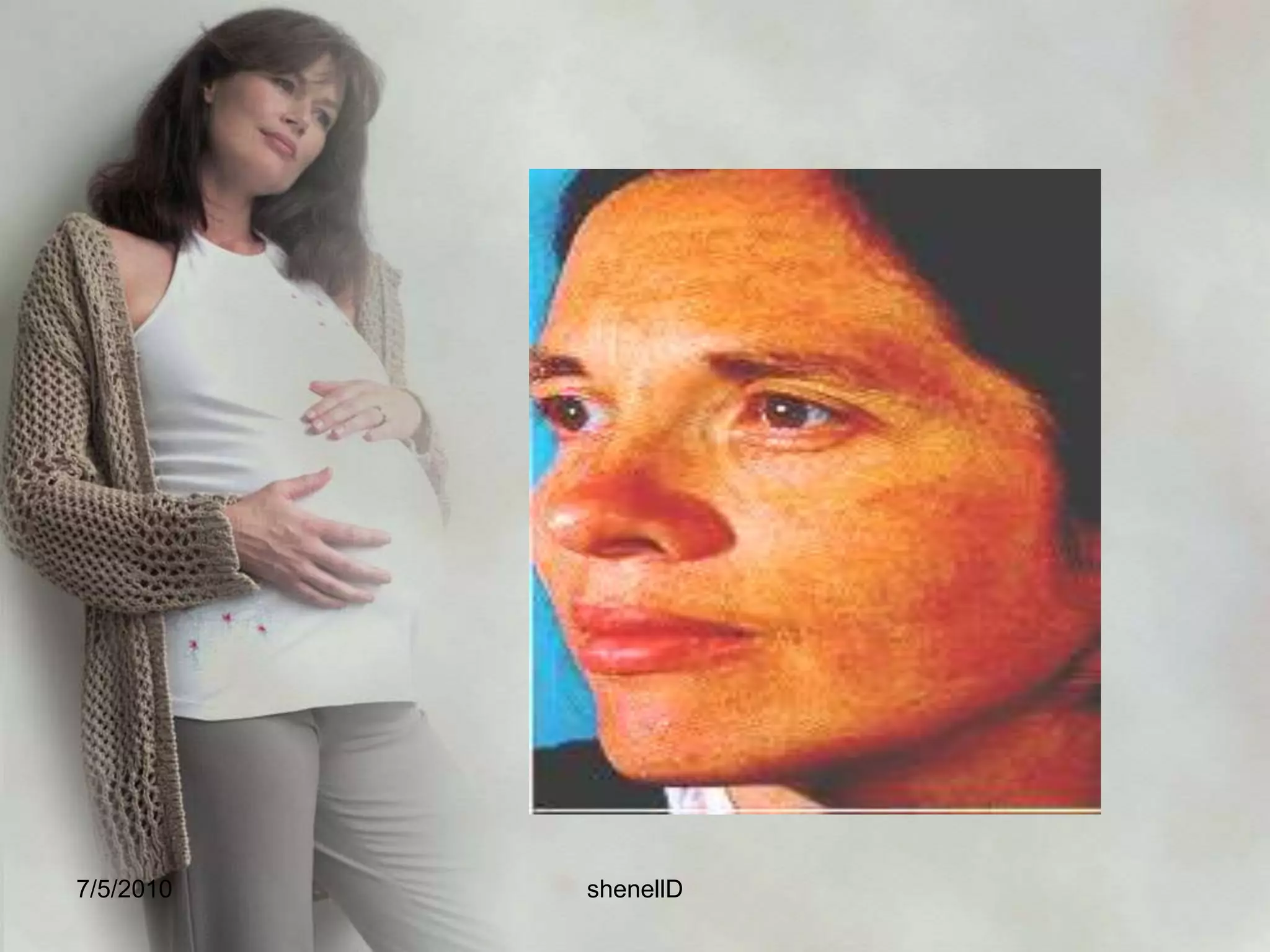 Functions:Provides a cushion against injuryProtects the fetus from changes in temperatureProtects the umbilical cord from pressure, protecting fetal oxygenationAids muscular developmentExcretion collection systemThe fetus drinks the fluid 7/4/2010shenellD