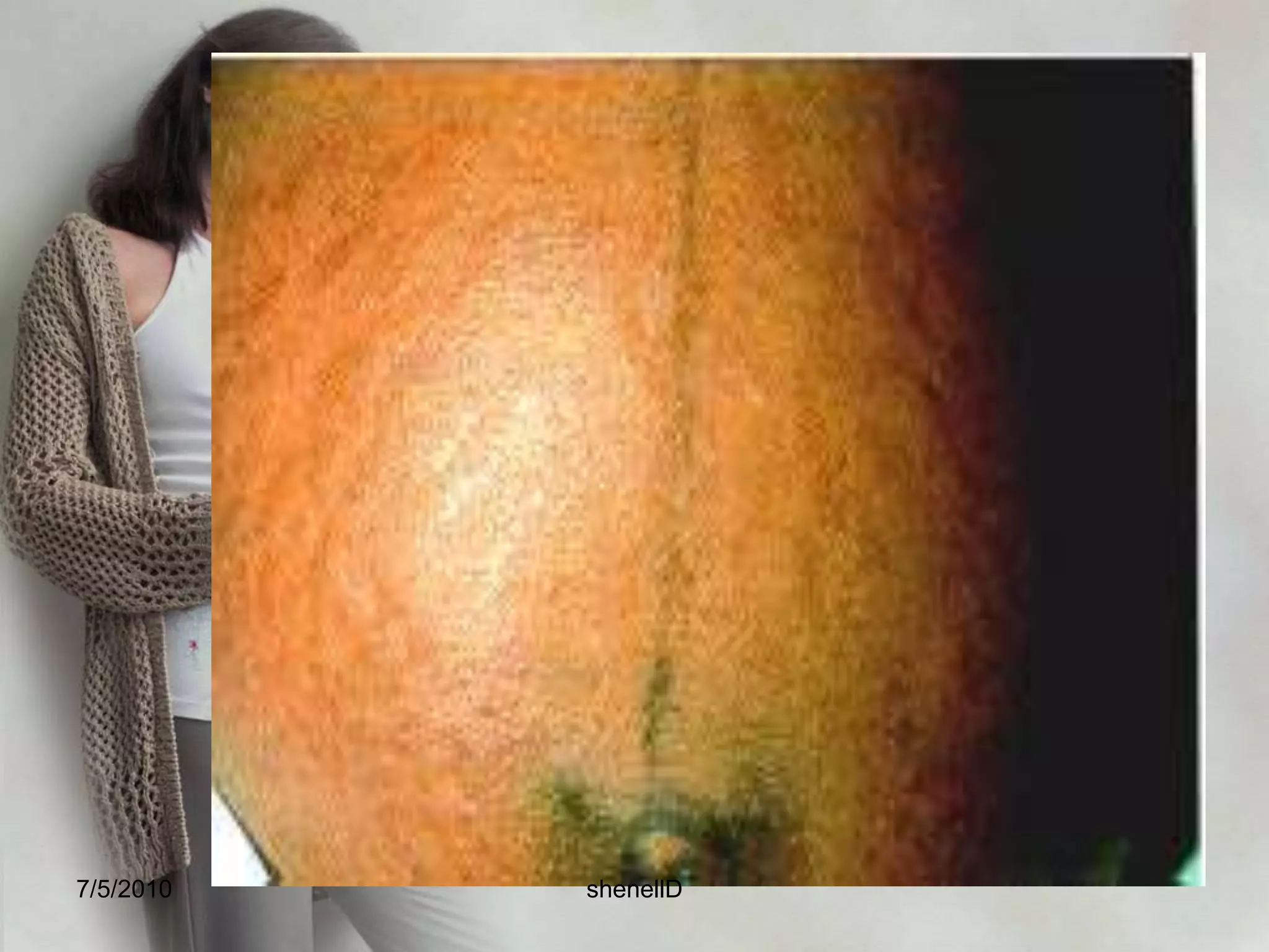 Care of the pregnant woman Physiologic change of pregnancy7/4/2010shenellD