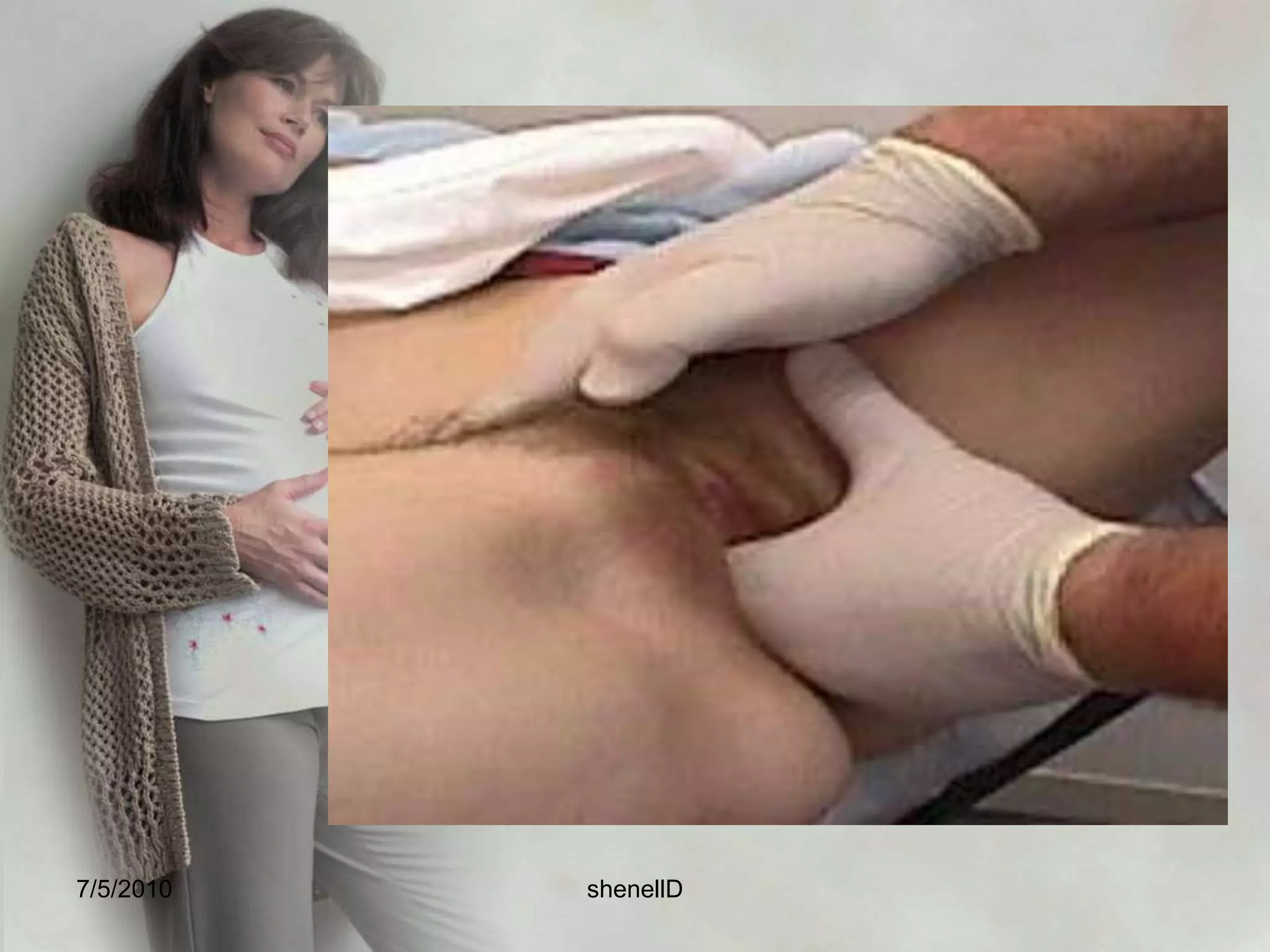 Vagina – Chadwick’s sign – purplish discoloration Leukorrhea– thick whitish vaginal discharge without signs of itching.7/4/2010shenellD