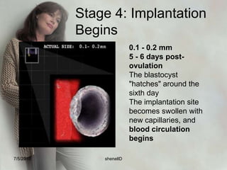 stages7/4/2010shenellD