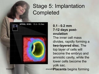 Stage 1: Fertilization1 day post-ovulation1 Egg, 300 Million Sperm0.1 - 0.15 mmFertilization begins when a sperm penetrates an an egg  and it ends with the creation of the zygote. Fertilization takes about 24 hours.7/4/2010shenellD