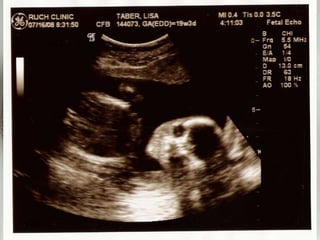 Stage 4: Implantation Begins0.1 - 0.2 mm5 - 6 days post-ovulationThe blastocyst "hatches" around the sixth dayThe implantation site becomes swollen with new capillaries, and blood circulation begins7/4/2010shenellD