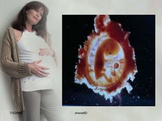 The placentaArises out of trophoblast tissue. It contains 20 cotyledons and weighs 400-600 grams. The rate of uteroplacental blood flow in pregnancy increases about 50 ml/min at 10 weeks to 500 to 600 ml/min at term. It develops by the third month and formed by union of chorionic villi and deciduas basalis. 7/4/2010shenellD