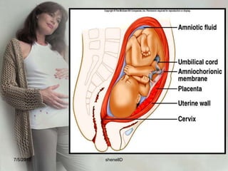 The umbilical cordFormed as chronic villi begins to function, initiating circulatory communication with the maternal blood pools joined together into larger veins and arteries; about 21 inches in length at term and 2cm in thicknessContains one vein and two arteries ( AVA)7/4/2010shenellD