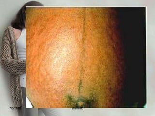 Care of the pregnant woman Physiologic change of pregnancy7/4/2010shenellD