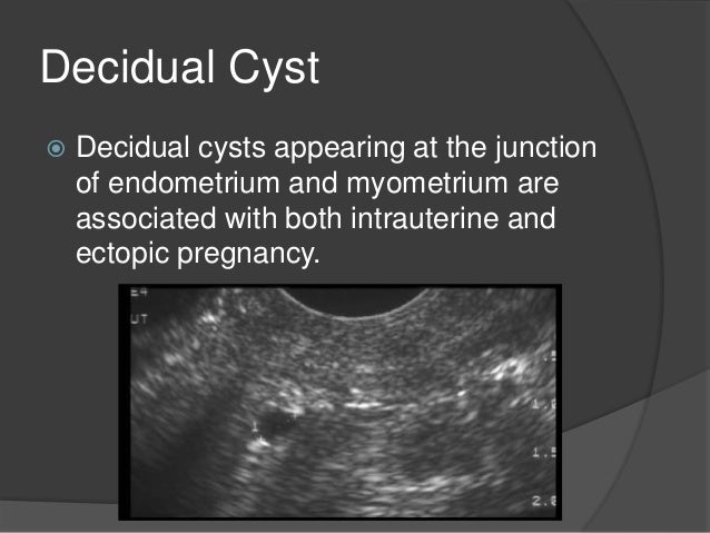 Pregnancy of unkown location