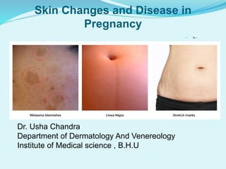 Skin Changes and Disease in
Pregnancy
 By—
Dr. Usha Chandra
Department of Dermatology And Venereology
Institute of Medical science , B.H.U
 