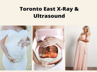 Pregnancy Ultrasound in Toronto - Toronto East X-Ray & Ultrasound