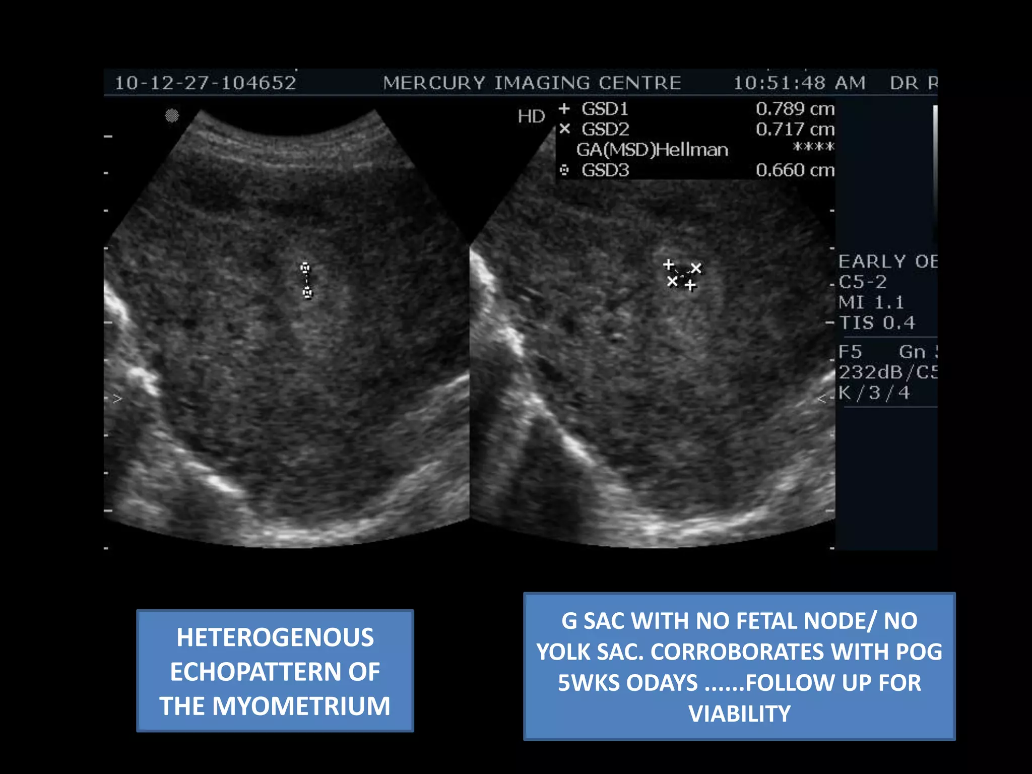 Congested  venous system.