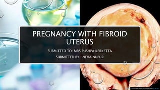 PREGNANCY WITH FIBROID
UTERUS
SUBMITTED TO: MRS PUSHPA KERKETTA
SUBMITTED BY : NEHA NUPUR
This Photo by Unknown Author is licensed under CC BY-SA
 