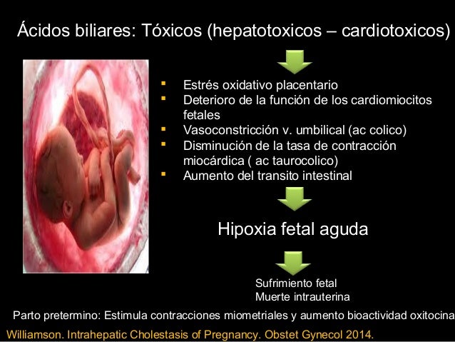 Colestasis Y Embarazo