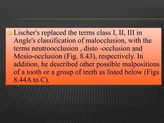 Classification of malooclusion | PPTX