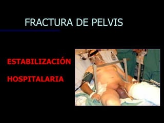 FRACTURA DE PELVIS


ESTABILIZACIÓN

HOSPITALARIA
 