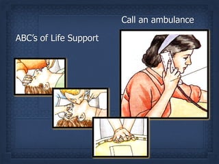 ABC’s of Life Support
Call an ambulance
 