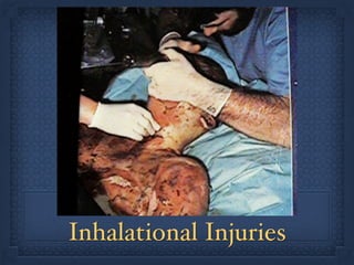 Inhalational Injuries
 