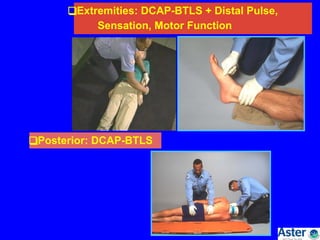 Prehospital care 'n' trauma life support | PDF