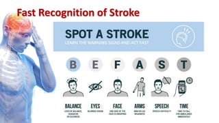 Fast Recognition of Stroke
 