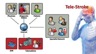 Tele-Stroke
 