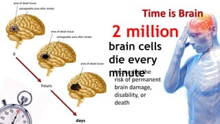 Time is Brain
brain cells
die every
minuteincreasing the
risk of permanent
brain damage,
disability, or
death
2 million
 
