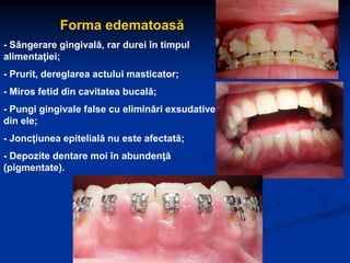 Forma edematoasă
- Sângerare gingivală, rar durei în timpul
alimentaţiei;
- Prurit, dereglarea actului masticator;
- Miros fetid din cavitatea bucală;
- Pungi gingivale false cu eliminări exsudative
din ele;
- Joncţiunea epitelială nu este afectată;
- Depozite dentare moi în abundenţă
(pigmentate).
 