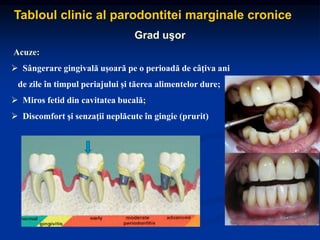 Tabloul clinic al parodontitei marginale cronice
Grad uşor
Acuze:
 Sângerare gingivală uşoară pe o perioadă de câţiva ani
de zile în timpul periajului şi tăerea alimentelor dure;
 Miros fetid din cavitatea bucală;
 Discomfort şi senzaţii neplăcute în gingie (prurit)
 