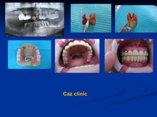 Caz clinic
 
