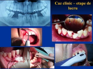 Caz clinic – etape de
lucru
 
