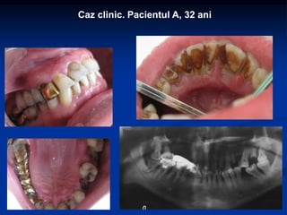 Caz clinic. Pacientul A, 32 ani
 