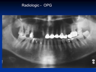 Radiologic - OPG
 