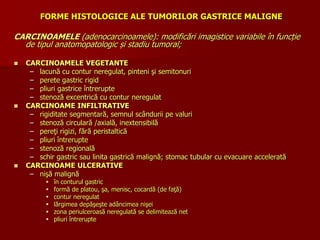FORME HISTOLOGICE ALE TUMORILOR GASTRICE MALIGNE
CARCINOAMELE (adenocarcinoamele): modificări imagistice variabile în funcție
de tipul anatomopatologic și stadiu tumoral;
 CARCINOAMELE VEGETANTE
– lacună cu contur neregulat, pinteni şi semitonuri
– perete gastric rigid
– pliuri gastrice întrerupte
– stenoză excentrică cu contur neregulat
 CARCINOAME INFILTRATIVE
– rigiditate segmentară, semnul scândurii pe valuri
– stenoză circulară /axială, inextensibilă
– pereţi rigizi, fără peristaltică
– pliuri întrerupte
– stenoză regională
– schir gastric sau linita gastrică malignă; stomac tubular cu evacuare accelerată
 CARCINOAME ULCERATIVE
– nişă malignă
 în conturul gastric
 formă de platou, şa, menisc, cocardă (de faţă)
 contur neregulat
 lărgimea depăşeşte adâncimea nişei
 zona periulceroasă neregulată se delimitează net
 pliuri întrerupte
 
