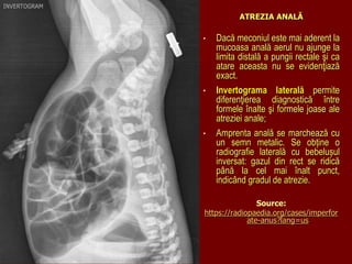 ATREZIA ANALĂ
• Dacă meconiul este mai aderent la
mucoasa anală aerul nu ajunge la
limita distală a pungii rectale şi ca
atare aceasta nu se evidenţiază
exact.
• Invertograma laterală permite
diferenţierea diagnostică între
formele înalte şi formele joase ale
atreziei anale;
• Amprenta anală se marchează cu
un semn metalic. Se obține o
radiografie laterală cu bebelușul
inversat: gazul din rect se ridică
până la cel mai înalt punct,
indicând gradul de atrezie.
Source:
https://radiopaedia.org/cases/imperfor
ate-anus?lang=us
 