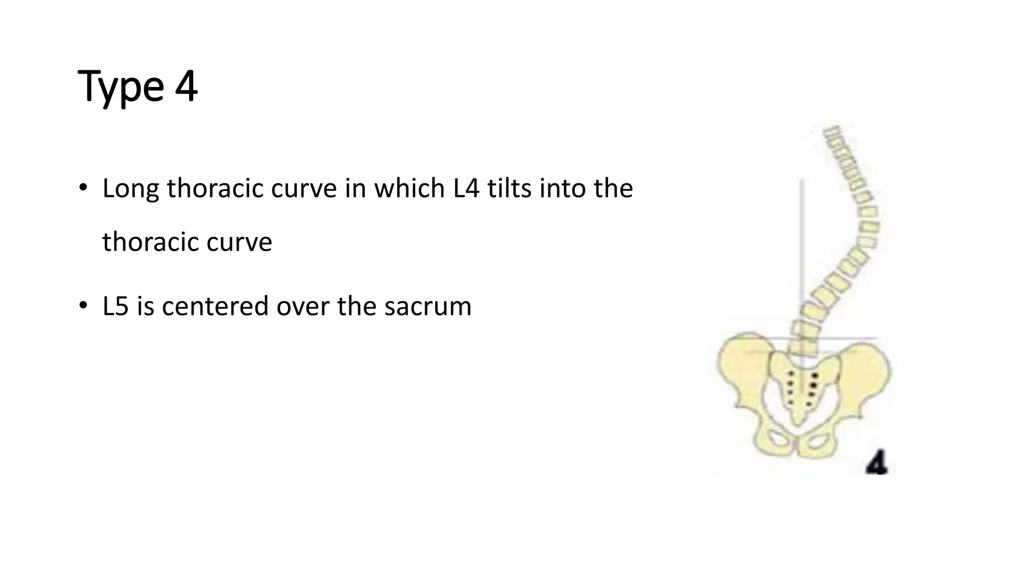 Lenke Classification Flowchart Pre lenke scoliosis classification.pptx
