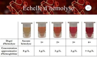 Échelle d’hémolyse S/A
 