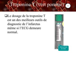 Troponine T (vert pomme)
Le dosage de la troponine T
est un des meilleurs outils de
diagnostic de l’infarctus
même si l’ECG demeure
normal.
S/A
 