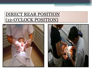 DIRECT REAR POSITION
(12-O’CLOCK POSITION)
 