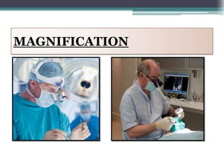 MAGNIFICATION
 